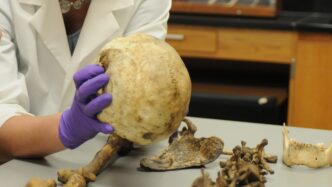 A person wearing a white lab coat and purple gloves holds a human skull in a lab setting